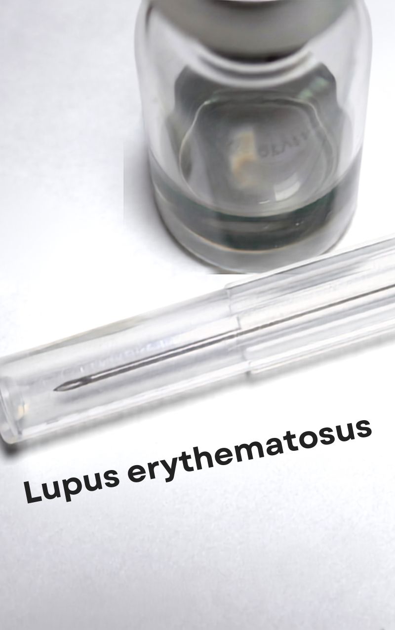 Lúpus Eritematoso Sistémico